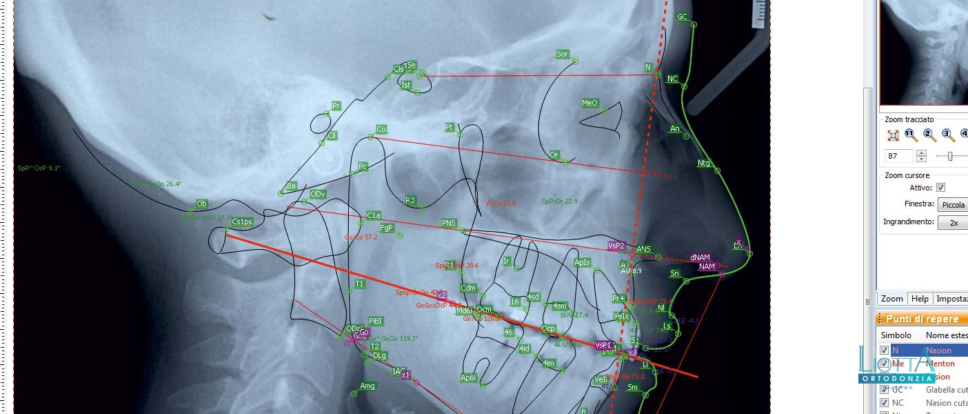 Liotta laboratorio ortodontico a Palermo produce Cefalometrie